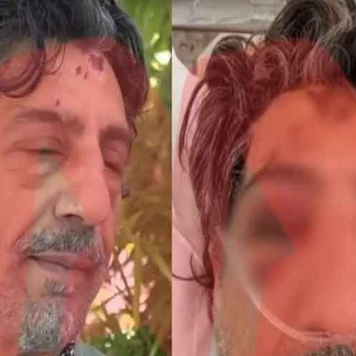 «ΕΣΠΑΣΑΝ» το κεφάλι οδηγού με τσιμεντόλιθο – «Αν είχε επιβάτες, θα τους “ΜΑΖΕΥΑΝ” από το δρόμο»