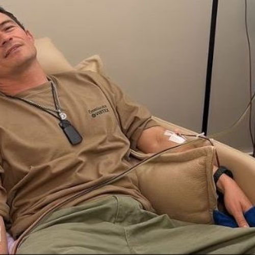 Ο Ορλάντο Μπλουμ «αφαίρεσε» μικροπλαστικά και τοξικά χημικά από το αίμα του με αμφιλεγόμενη θεραπεία