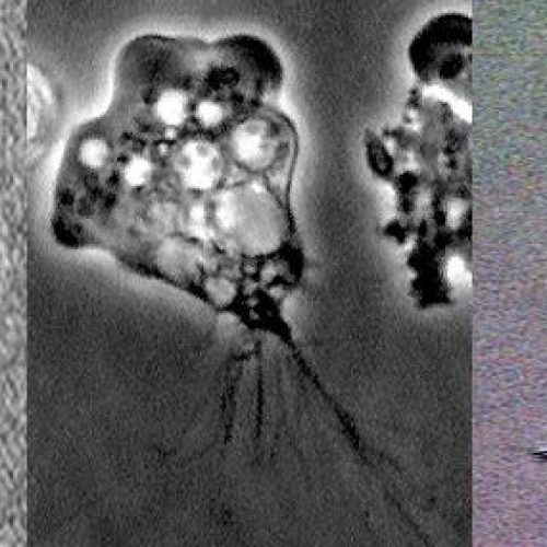 By CDC - CDC free living amoeba image library archived from the original, Public Domain, https://commons.wikimedia.org/w/index.php?curid=8692071
