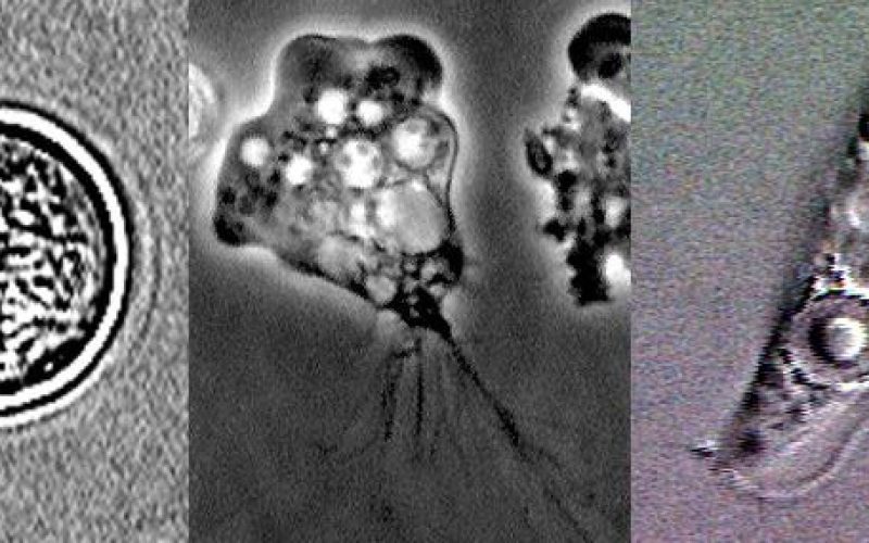 By CDC - CDC free living amoeba image library archived from the original, Public Domain, https://commons.wikimedia.org/w/index.php?curid=8692071