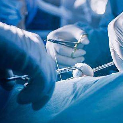 Εφιάλτης για 20χρονη στη Θεσσαλονίκη: Από επέμβαση ρουτίνας, με βαρύτατα εγκαύματα τρίτου βαθμού