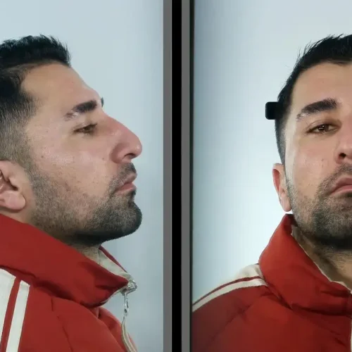 Θεσσαλονίκη: Αυτός είναι ο 23χρονος Αφγανός που κατηγορείται ότι έδινε ναρκωτικά σε ανήλικα κορίτσια και τα βίαζε