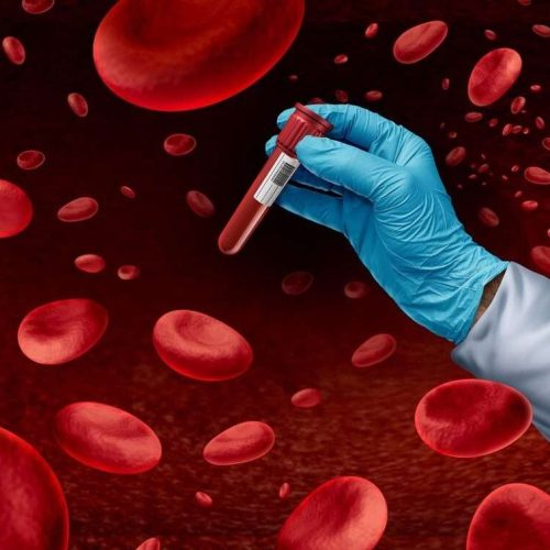 Ποιο «τεστ αίματος» θα μπορούσε να προβλέψει πόσο θα ζήσετε