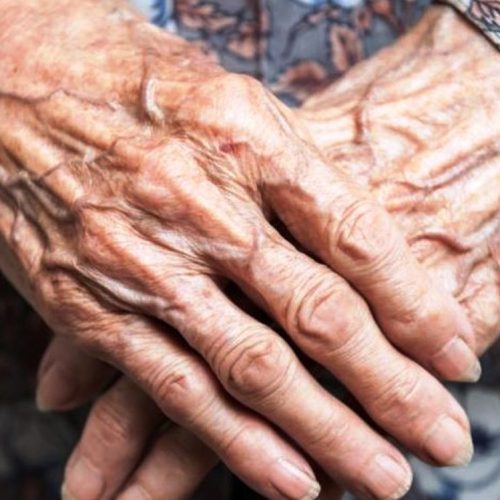 Χίος: Κακοποίηση ηλικιωμένης με άνοια από 67χρονη που είχε αναλάβει την φροντίδα της – Αφέθηκε ελεύθερη