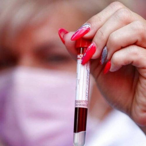 Μπορεί μια εξέταση αίματος να προβλέψει τον κίνδυνο θανάτου μέσα στην επόμενη δεκαετία;