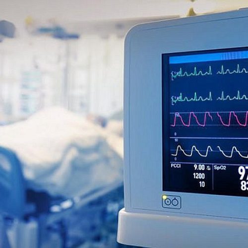 Λαμία – Διασωληνωμένος στη ΜΕΘ ένας 21χρονος μετά από τροχαίο