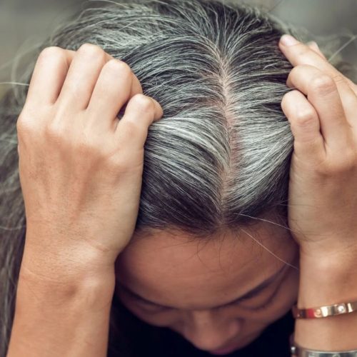 Η βιταμίνη που μπορεί να επιβραδύνει το γκριζάρισμα των μαλλιών – Σε ποιες τροφές βρίσκεται