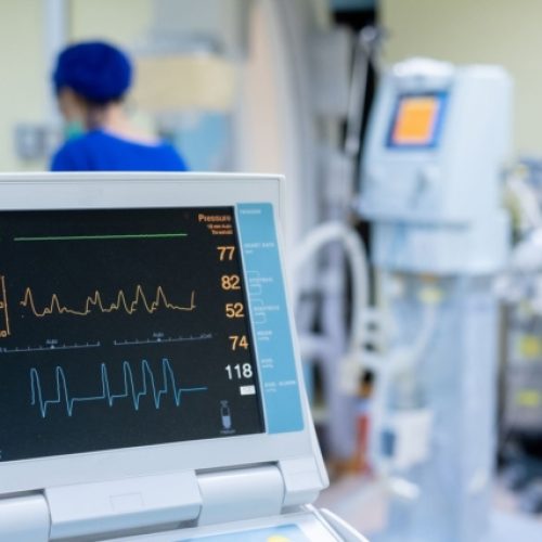 EKG monitor in intra aortic balloon pump machine. Medical equipment