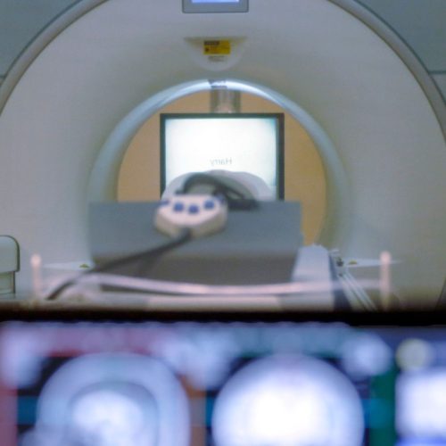 Πέθανε άνδρας που «ρουφήχθηκε» από μαγνητικό τομογράφο