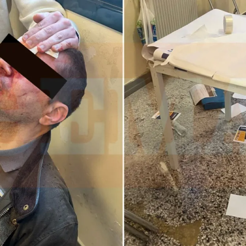 «ΕΚΡΗΞΗ ΒΙΑΣ» στη Νομική Αθηνών – Στο νοσοκομείο διδακτορικός φοιτητής, τον ΧΤΥΠΗΣΑΝμε πυροσβεστήρα (Φώτο)
