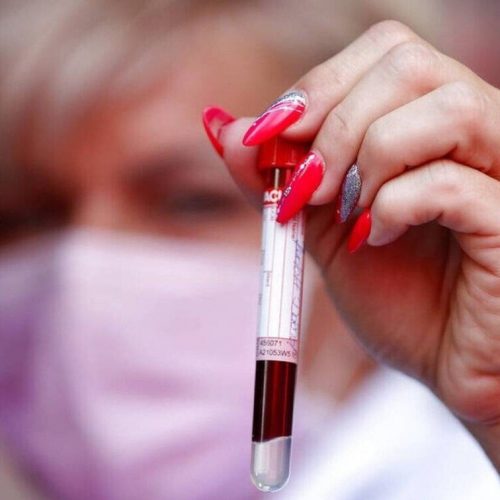 Θα πεθάνετε μέσα στα επόμενα δέκα χρόνια; Μια εξέταση αίματος μπορεί να αποκαλύψει την αλήθεια