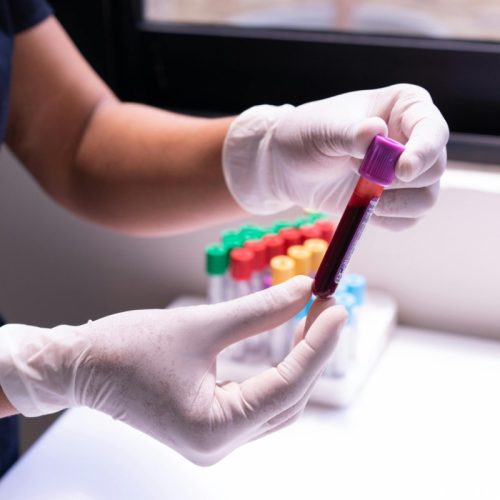 «Καμπανάκι» για τις λοιμώξεις αίματος – Τι παρατηρείται στην Ευρώπη