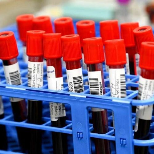 «ΣΟΚ» Έδωσαν λάθος αίμα σε ασθενή – Κατέρρευσε ο οργανισμός της!