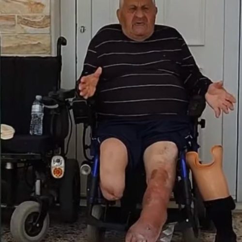 ΠΕΘΑΝΕ Ο 84χρονος ΑΝΑΠΗΡΟΣ ΠΟΥ ΤΟΝ ΠΕΤΟΥΣΕ ΕΞΩ Η ΑΣΤΥΝΟΜΙΑ ΚΑΙ ΤΑ ΚΟΡΑΚΙΑ ΜΕ ΑΛΛΕΠΑΛΛΗΛΕΣ ΕΞΩΣΕΙΣ (ΒΙΝΤΕΟ ΑΠΟ ΤΗΝ ΤΕΛΕΥΤΑΙΑ ΤΟΥ ΕΞΩΣΗ)