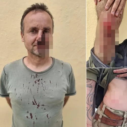 Απίστευτο συμβάν στη Ζάκυνθο – Λαθροκυνηγοί επιτέθηκαν σε ορνιθολόγους